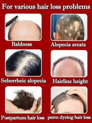 Hair Growth Serum