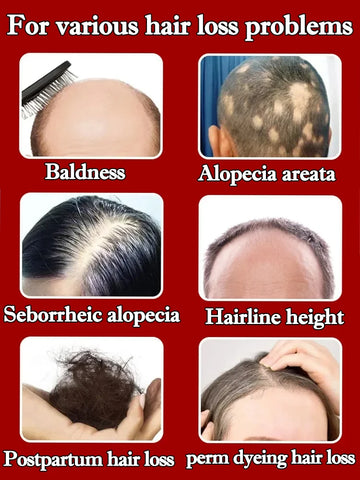 Hair Growth Serum