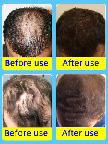 Hair Growth Serum