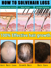 Hair Growth Serum