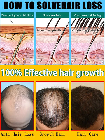 Hair Growth Serum