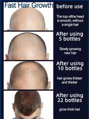 Hair Growth Serum